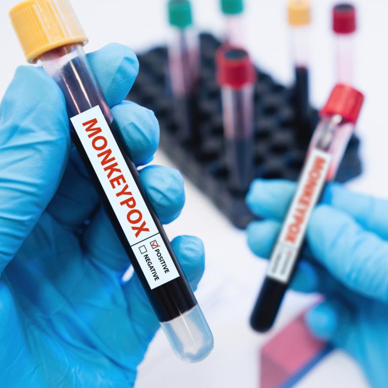 Considerations for monkeypox